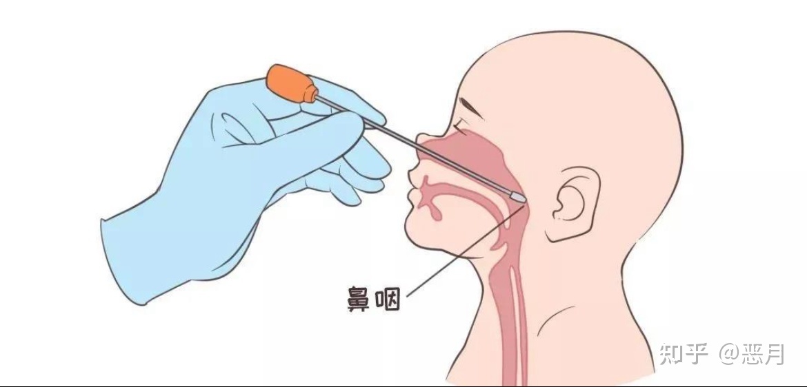 鼻咽拭子2